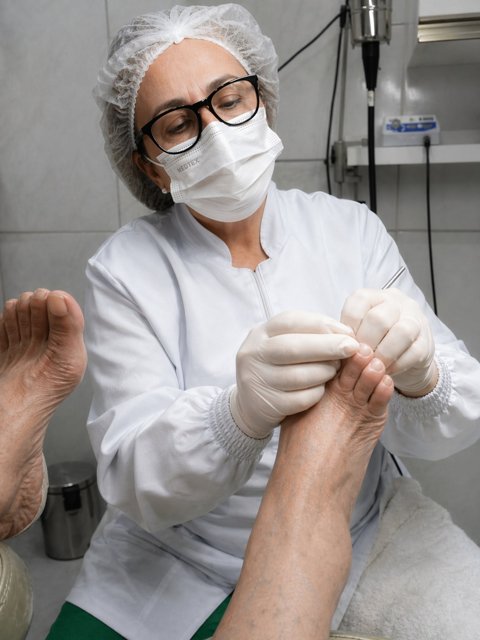 Profissional da ZL Podologia fazendo retirada de espícula de unha encravada com instrumento fino e técnica precisa em Fortaleza